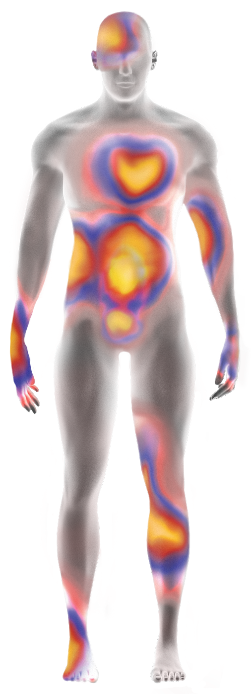 A diagram showing symptom areas of ATTR amyloidosis